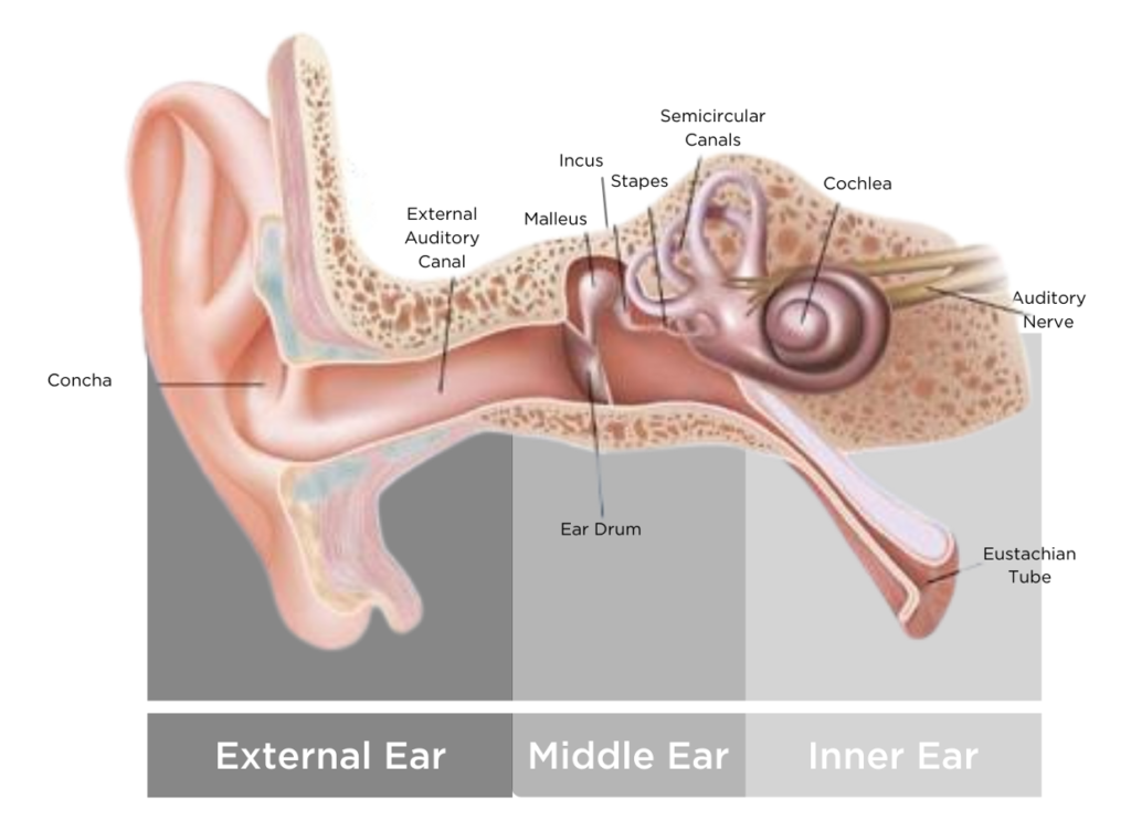 The Stapes in Otosclerosis: Osteoarthritis of an Ear Ossicle